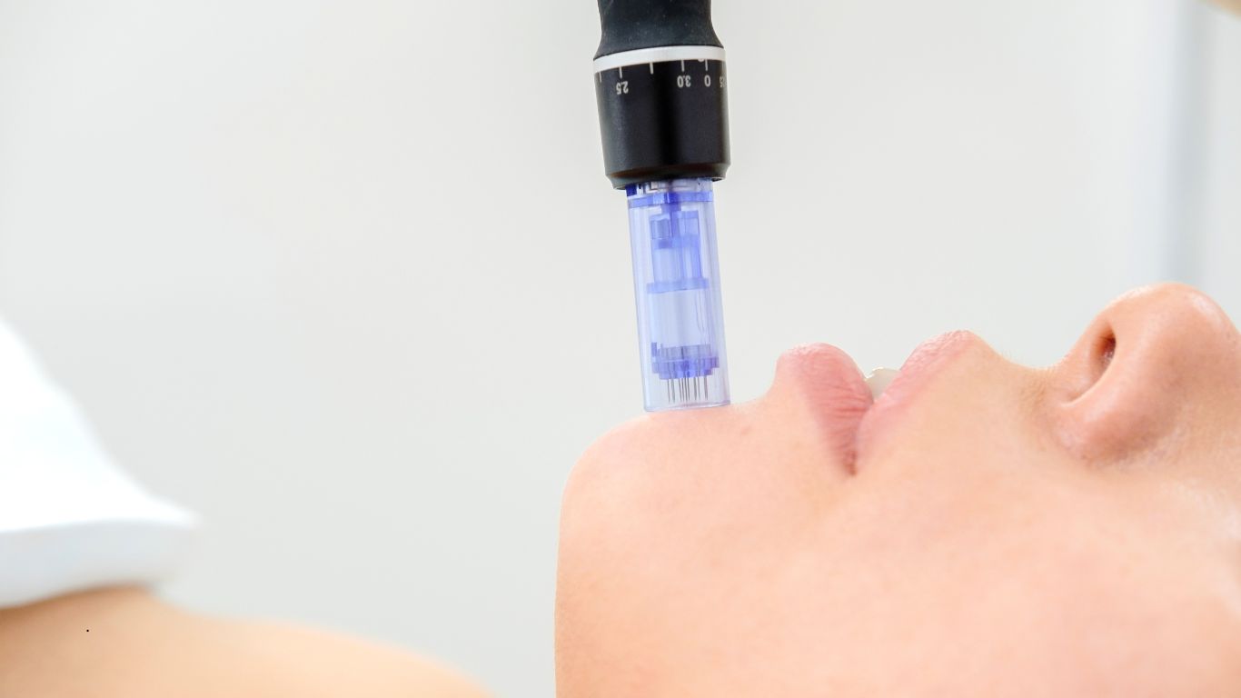 microneedling long header