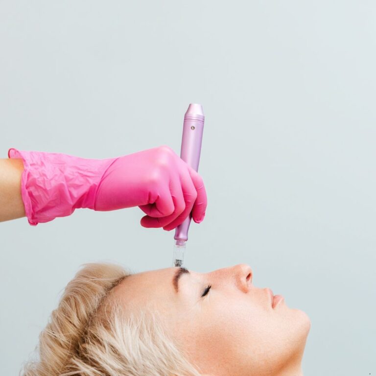 microneedling picture