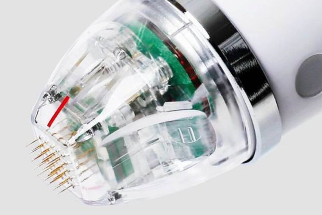 rf+microneedling+(1)