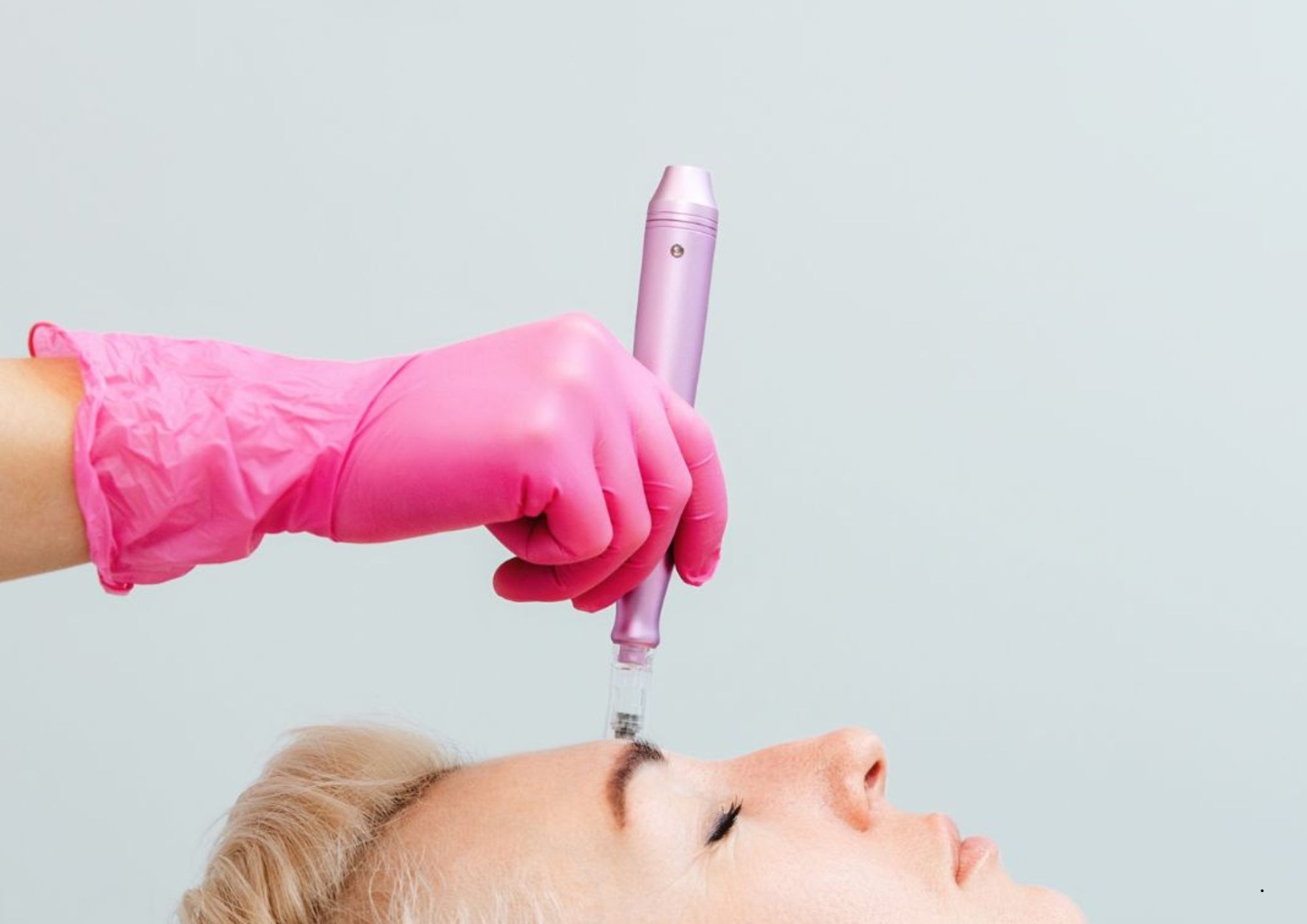 Micro Needling Razor Advanced Micro-Needling in Saffron Walden | Bare Beauty Clinic